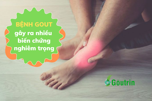 Bệnh gout nếu không điều trị từ sớm sẽ gây ra những hệ lụy cho các cơ quan khác