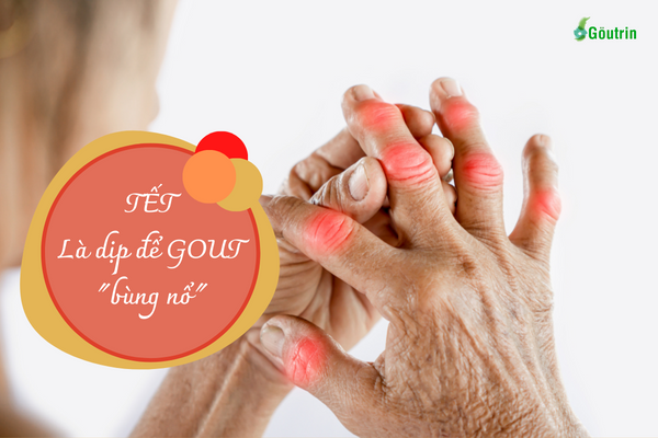 Có nhiều yếu tố ngày Tết khiến bệnh gout khó kiểm soát